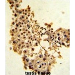 G1/S-Specific Cyclin-E1 (CCNE1) Antibody