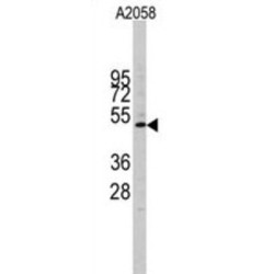 G1/S-Specific Cyclin-E1 (CCNE1) Antibody