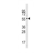 Cell Division Cycle 25A (Cdc25A) Antibody
