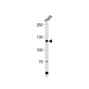 Histone Cell Cycle Regulator (HIRA) Antibody