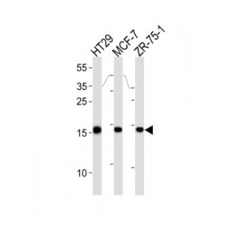 Anterior Gradient Protein 2 Homolog (AGR2) Antibody