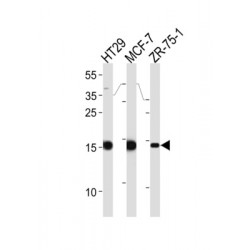 Anterior Gradient Protein 2 Homolog (AGR2) Antibody