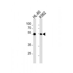 Myocyte Enhancer Factor 2C (MEF2C) Antibody