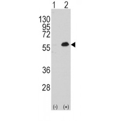 Myocyte Enhancer Factor 2C (MEF2C) Antibody