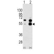 Vascular Endothelial Growth Factor A (VEGFA) Antibody