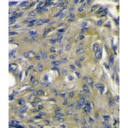 Vascular Endothelial Growth Factor D / FIGF (VEGFD) Antibody