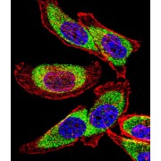 Nuclease-Sensitive Element-Binding Protein 1 (YBX1) Antibody