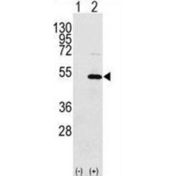 Nuclease-Sensitive Element-Binding Protein 1 (YBX1) Antibody