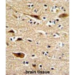 Beta-Amyloid Precursor Protein (APP) Antibody