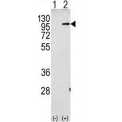 Beta-Amyloid Precursor Protein (APP) Antibody