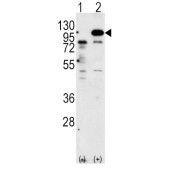 Amyloid-beta Precursor Protein (APP) Antibody