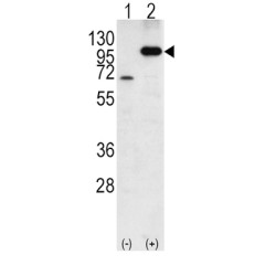 Amyloid-beta Precursor Protein (APP) Antibody