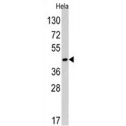 Cell Cycle Checkpoint Control Protein RAD9A (RAD9) Antibody