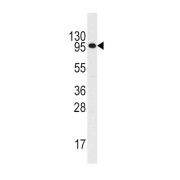 Colony Stimulating Factor 2 Receptor Beta (CSF2RB) Antibody