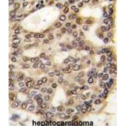 Hepatoma Derived Growth Factor (HDGF) Antibody