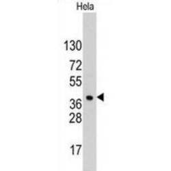 Hepatoma Derived Growth Factor (HDGF) Antibody