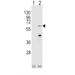 Serine/Threonine-Protein Kinase PINK1, Mitochondrial (PINK1) Antibody