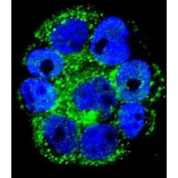 Interleukin 1 Receptor Antagonist (IL1RN) Antibody