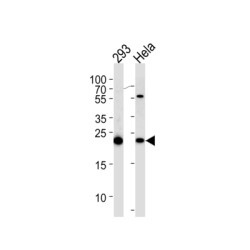 Interleukin 1 Receptor Antagonist (IL1RN) Antibody