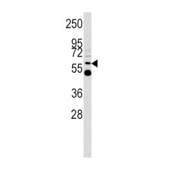 UDP-Glucuronosyltransferase 2B17 (UDB17) Antibody