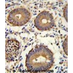 Carcinoembryonic Antigen (CEACAM5) Antibody