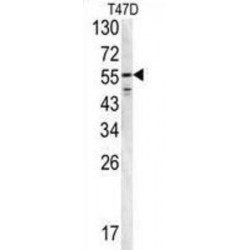 Fibrinogen Beta (FGB) Antibody