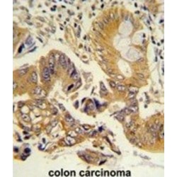 Chloride Nucleotide-Sensitive Channel 1A (CLNS1A) Antibody