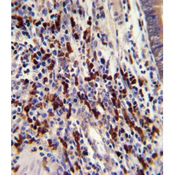 CCR4-NOT Transcription Complex Subunit 8 (CNOT8) Antibody