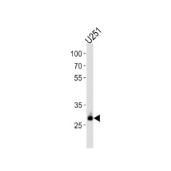 CCR4-NOT Transcription Complex Subunit 8 (CNOT8) Antibody