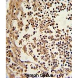 Eukaryotic Translation Elongation Factor 1 Delta (EEF1D) Antibody