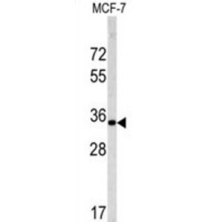 Emerin (EMD) Antibody