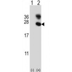 Fatty Acid Binding Protein 3, Muscle And Heart (FABP3) Antibody