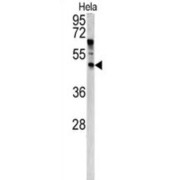 Angiopoietin-Related Protein 7 (ANGPTL7) Antibody