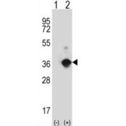 Angiopoietin-Related Protein 7 (ANGPTL7) Antibody