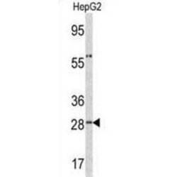 Alpha-1-Acid Glycoprotein 1 (ORM1) Antibody