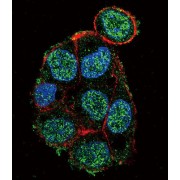 Von Hippel-Lindau Disease Tumor Suppressor (VHL) Antibody