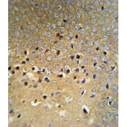 Von Hippel-Lindau Disease Tumor Suppressor (VHL) Antibody