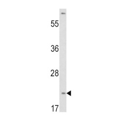 Von Hippel-Lindau Disease Tumor Suppressor (VHL) Antibody