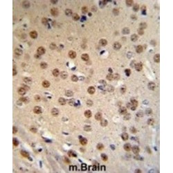 APC Membrane Recruitment Protein 1 (AMER1) Antibody