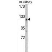 WB analysis of mouse kidney tissue lysates.