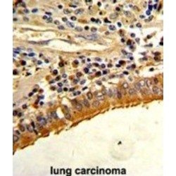 Osteopontin (SPP1) Antibody