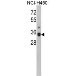 Osteopontin (SPP1) Antibody