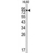 Inactive Carboxypeptidase-Like Protein X2 (CPXM2) Antibody