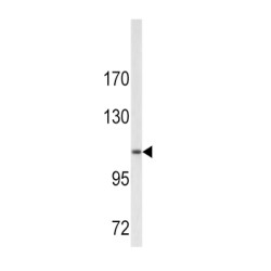 Collagen Type VI Alpha 1 (COL6A1) Antibody