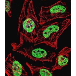 Krueppel-Like Factor 6 (KLF6) Antibody