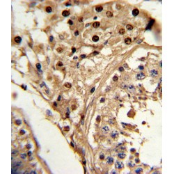 Krueppel-Like Factor 6 (KLF6) Antibody