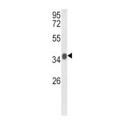 Western blot analysis of Mouse stomach tissue lysate (35 µl/lane) using KLF6 antibody.