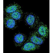 Eukaryotic Translation Elongation Factor 1 Alpha 1 (EEF1A1) Antibody