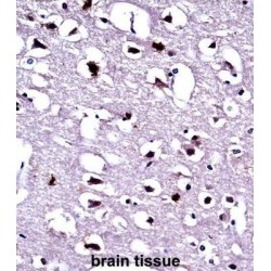 Eukaryotic Translation Elongation Factor 1 Alpha 1 (EEF1A1) Antibody