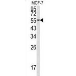 Eukaryotic Translation Elongation Factor 1 Alpha 1 (EEF1A1) Antibody